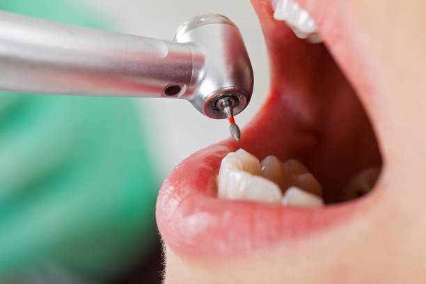 Best Urgent Tooth Repair  in Elizabethville, PA